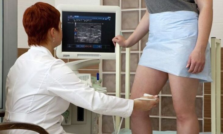 varisli damarların tedavisi için lazer pıhtılaşması